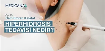 Hiperhidrosis Tedavisi Nedir?