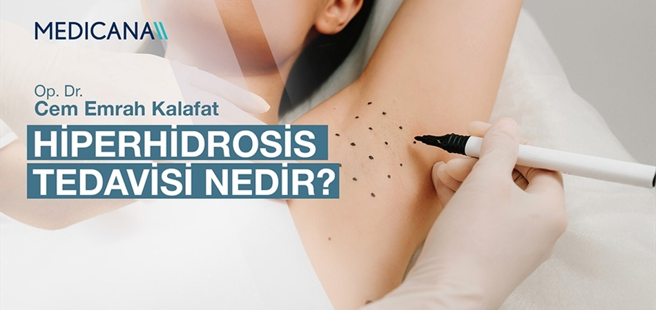 Hiperhidrosis Tedavisi Nedir?