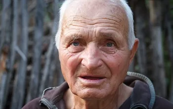 Hipokrat yüz nedir? Hipokrat yüzü neden olur?