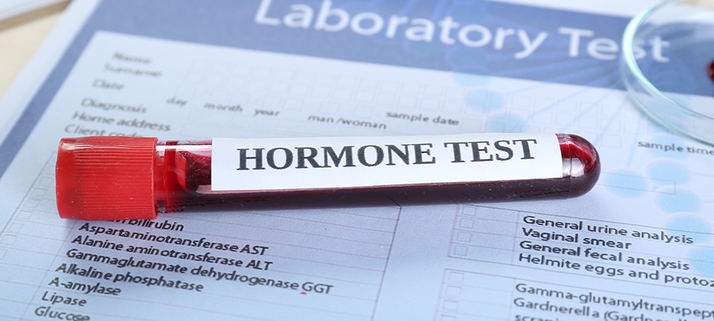 Hormon testi nedir? Hormon testi nasıl yapılır? 