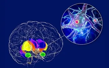 Huntington hastalığı nedir? Belirtileri, genetik nedenleri ve tedavi yaklaşımı