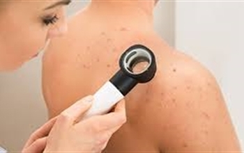 KIş Aylarında Yüz Bölgesinde Artış Gösteren Deri Hastalıkları