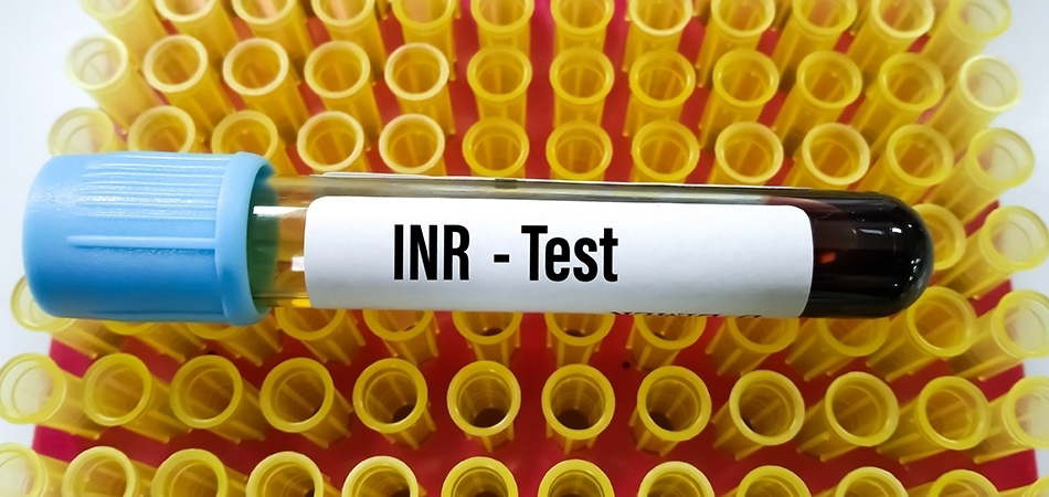 INR değeri: Kanın pıhtılaşma düzenini anlamak
