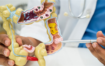 Kolonoskopi nedir, nasıl yapılır? Kolonoskopi işlemi ne kadar sürer?