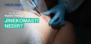 Jinekomasti Nedir?