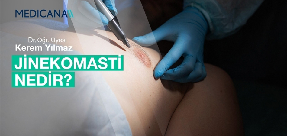 Jinekomasti Nedir?