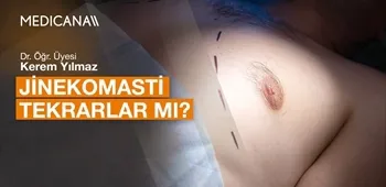 Jinekomasti Tekrarlar mı?