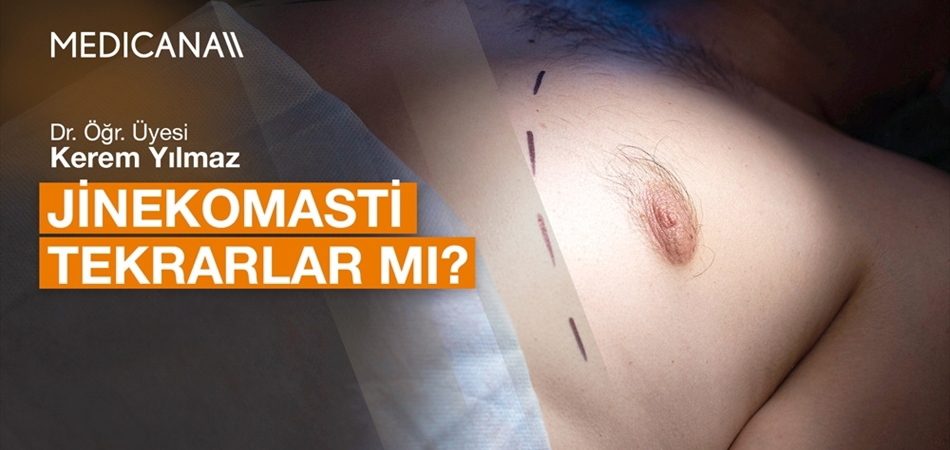 Jinekomasti Tekrarlar mı?