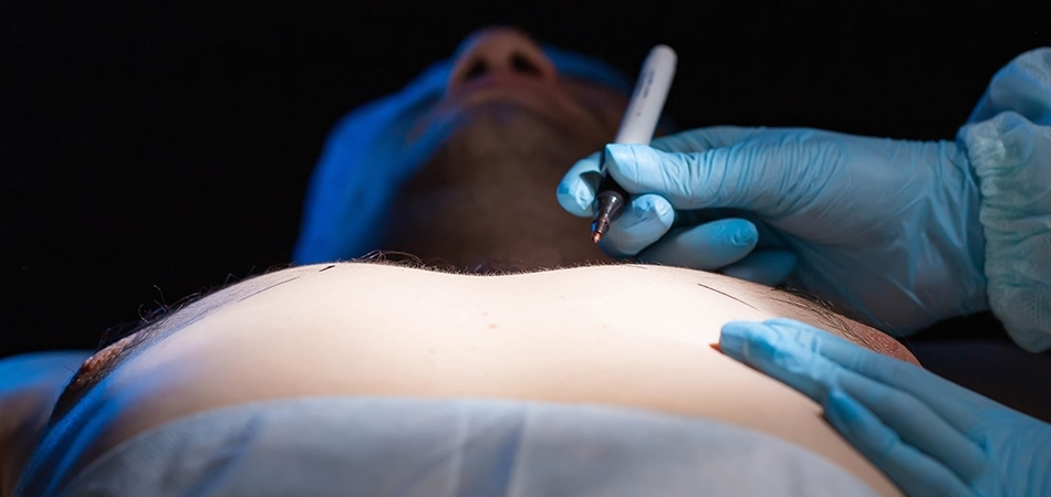 Jinekomasti nedir? Jinekomasti neden olur?