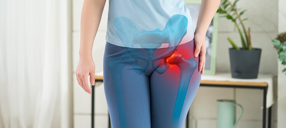 Kalçada kireçlenme neden olur? Kalça kireçlenmesinin belirtileri nelerdir?