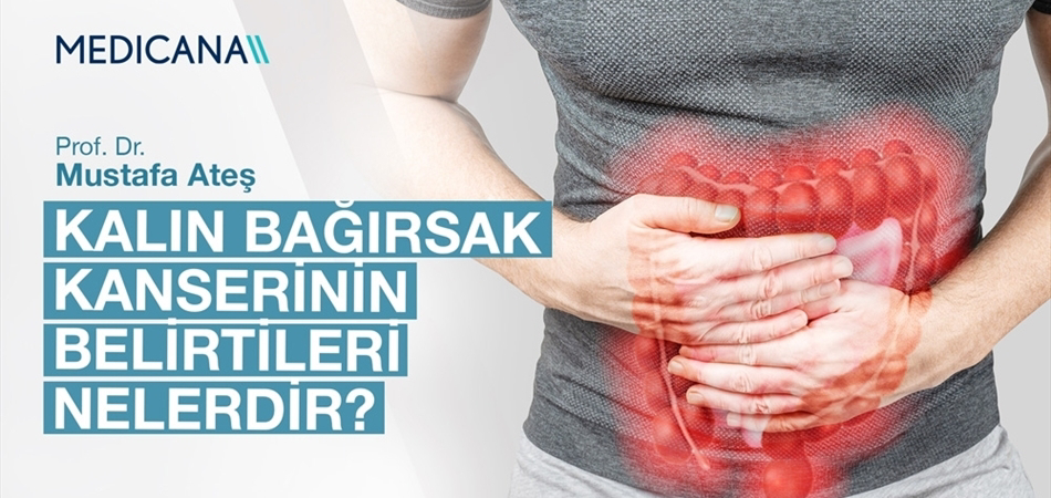 Kalın Bağırsak Kanserinin Belirtileri Nelerdir?