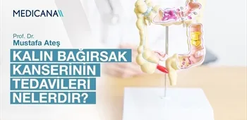 Kalın Bağırsak Kanserinin Tedavileri Nelerdir?