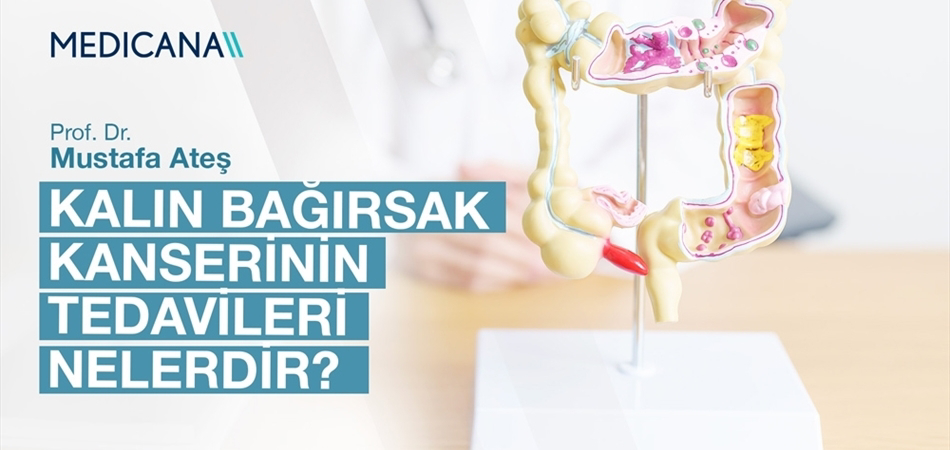 Kalın Bağırsak Kanserinin Tedavileri Nelerdir?