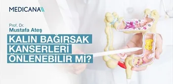 Kalın Bağırsak Kanserleri Önlenebilir mi?
