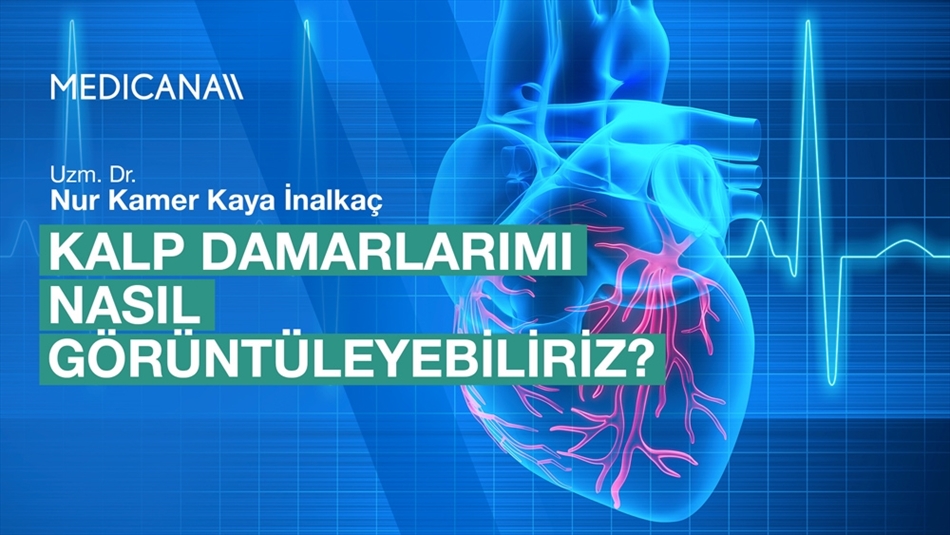 Kalp Damarlarımı Nasıl Görüntüleyebiliriz?