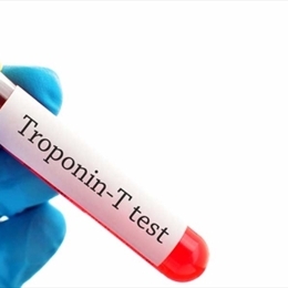 Kalp Krizinde Troponin Değeri