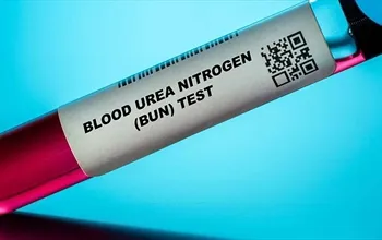 Kan üre azotu nedir? BUN yüksekliği ve düşüklüğü ne anlama gelir
