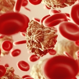 Kanda Enfeksiyon Nedir? Tedavi ve Teşhis Süreci