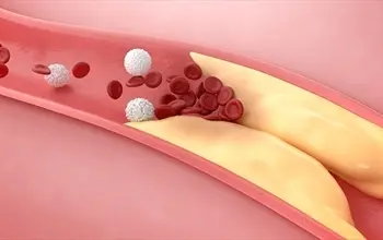 Kandaki yağı eriten bitkiler nelerdir? Kandaki yağı eritmek için nasıl beslenmeli?