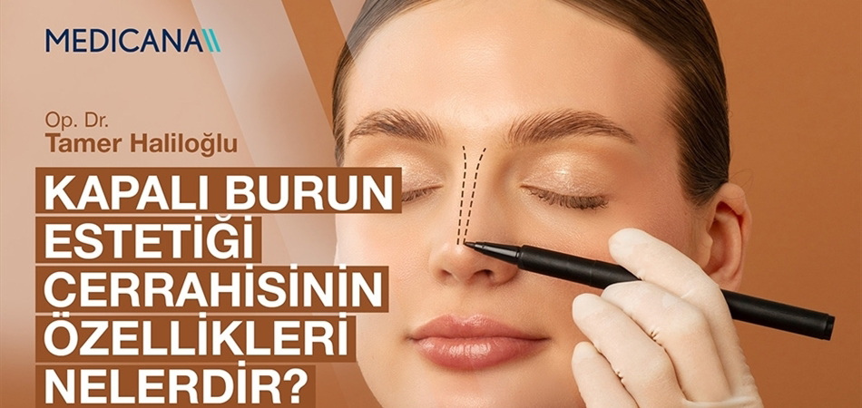 Kapalı Burun Estetiği Cerrahisinin Özellikleri Nelerdir?