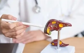 Karaciğer yağlanması nasıl tedavi edilir? Karaciğer yağlanması olunca ne olur?