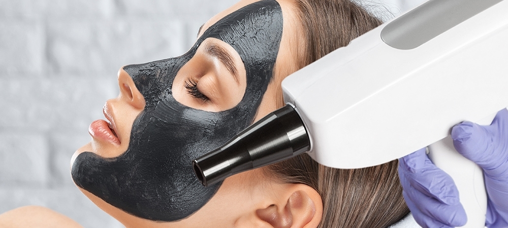 Karbon peeling ne işe yarıyor? Karbon peelingin faydaları neler?