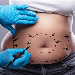 Karın Germe (Abdominoplasti)