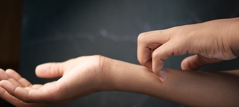 Kaşıntı neden olur? Kaşıntıya neden olan hastalıklar...