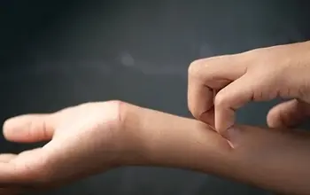 Kaşıntıya ne iyi gelir? Kaşıntı neden olur?