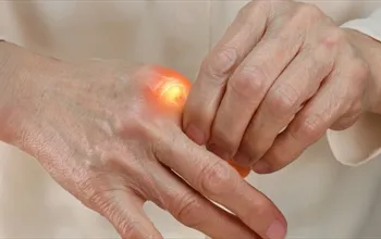 Kemik ağrısı neden olur? Kemik ağrısı nasıl geçer?