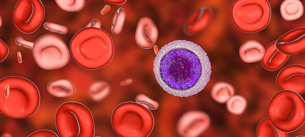 Kemik iliği kanseri nedir? Kemik iliği kanseri belirtileri nelerdir?