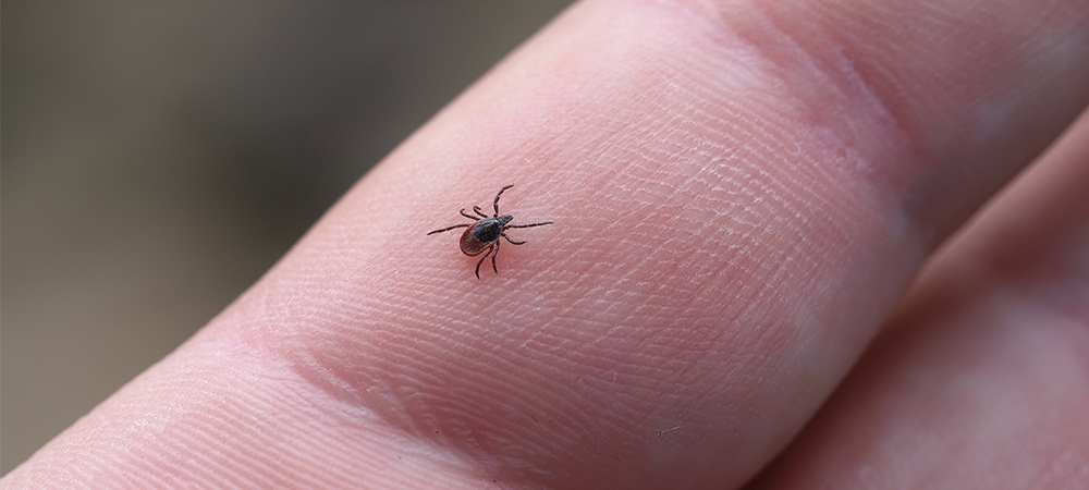 Kene ısırması belirtileri nelerdir? Kene ısırdığında neler yapılmalı?