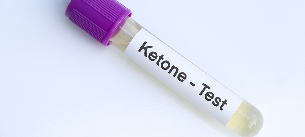 Keton nedir? Keton pozitif ne demek?