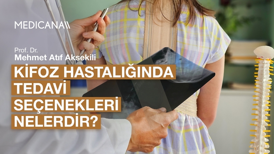 Kifoz Hastalığında Tedavi Seçenekleri Nelerdir?