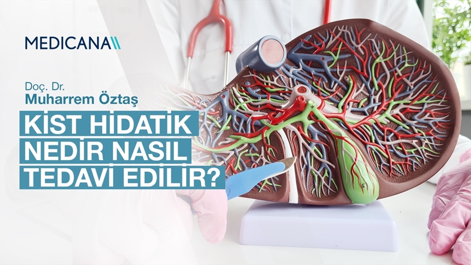 Kist Hidatik Nedir Nasıl Tedavi Edilir?