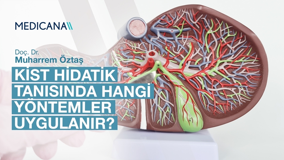 Kist Hidatik Tanısında Hangi Yöntemler Uygulanır?