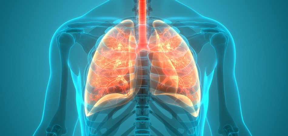 Kistik fibrozis nedir? Kistik fibrozis belirtileri nelerdir?