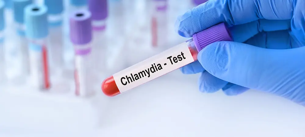 Klamidya nedir? Klamidya olduğu nasıl anlaşılır? Klamidya nedir? Klamidya olduğu nasıl anlaşılır?