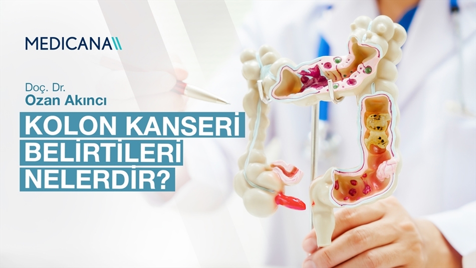 Kolon Kanseri Belirtileri Nelerdir?