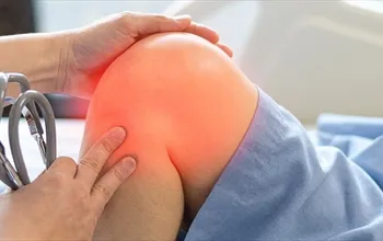 Kondromalazi patella nedir, diz ağrısının nedeni olabilir mi?