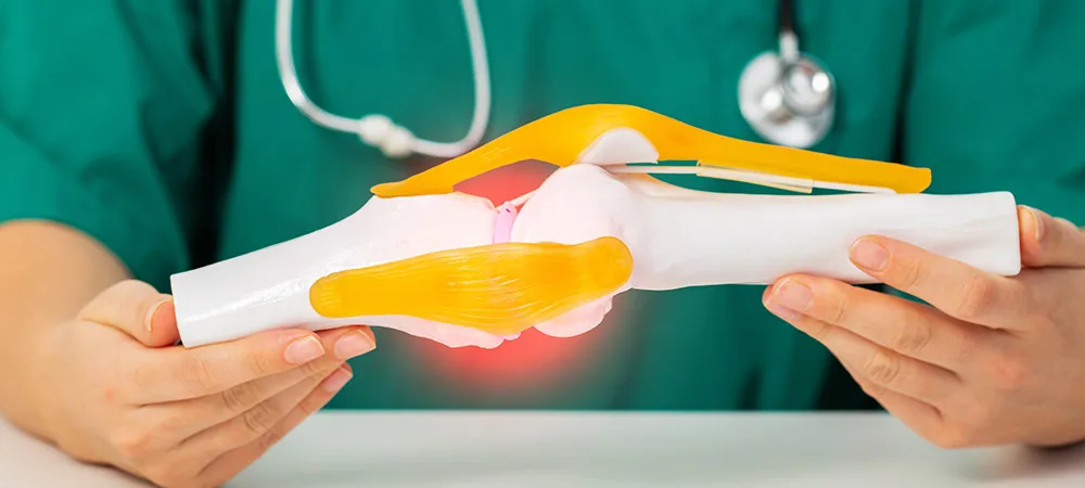 Kondromalazi patella nedir? Kondromalazi patellanın nedenleri neler? Kondromalazi patella nedir? Kondromalazi patellanın nedenleri neler?