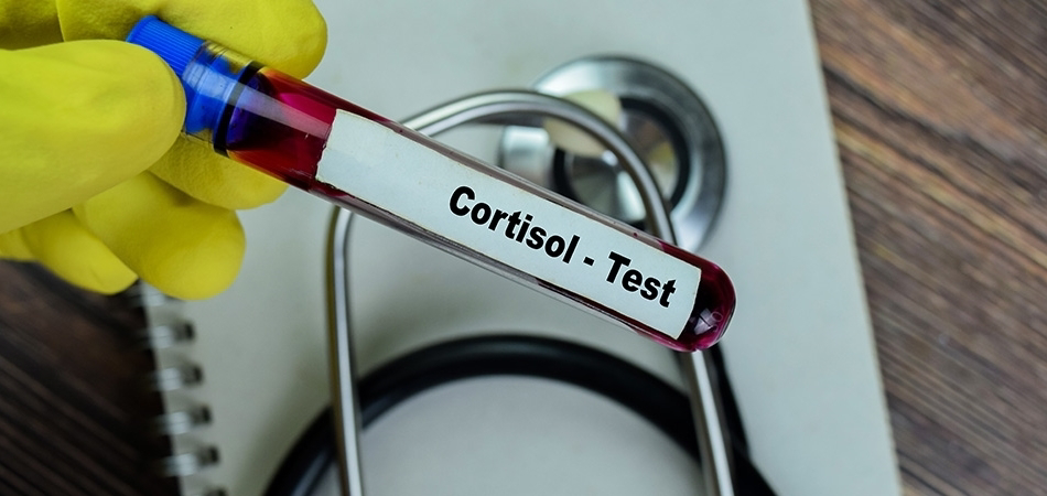 Kortizol testi nedir, nasıl yapılır? Sonuçlar ne anlama gelir?