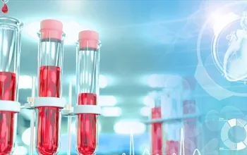 Kreatinin nedir? Kreatinin yüksekliği ne anlama gelir?