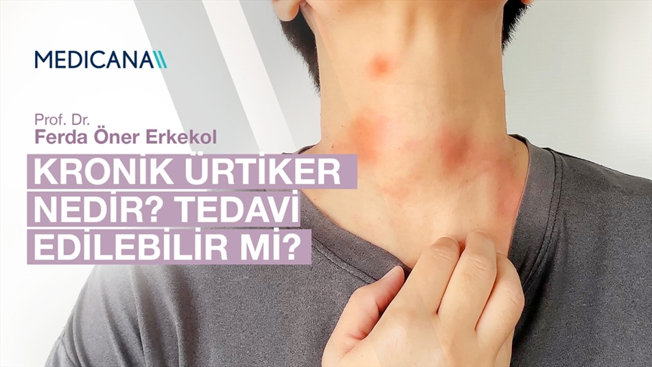 Kronik Ürtiker Nedir? Tedavi Edilebilir mi?