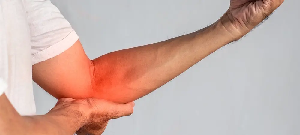 Kubital tünel sendromu nasıl geçer? Kubital tünel sendromu için hangi doktora gidilir? Kubital tünel sendromu nasıl geçer? Kubital tünel sendromu için hangi doktora gidilir?