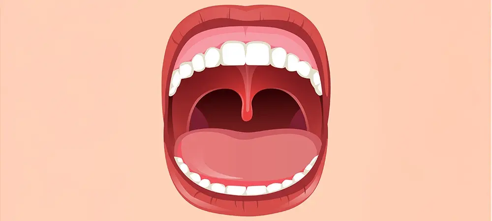 Küçük dil şişmesi neden olur? Küçük dil şişmesi nasıl iner? Küçük dil şişmesi neden olur? Küçük dil şişmesi nasıl iner?
