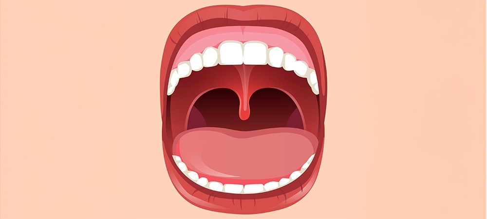 Küçük dil şişmesi neden olur? Küçük dil şişmesi nasıl iner?