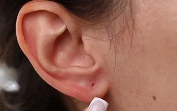 Kulak içinde siyah nokta: Nedenleri, belirtileri ve ne zaman doktora gidilmeli?