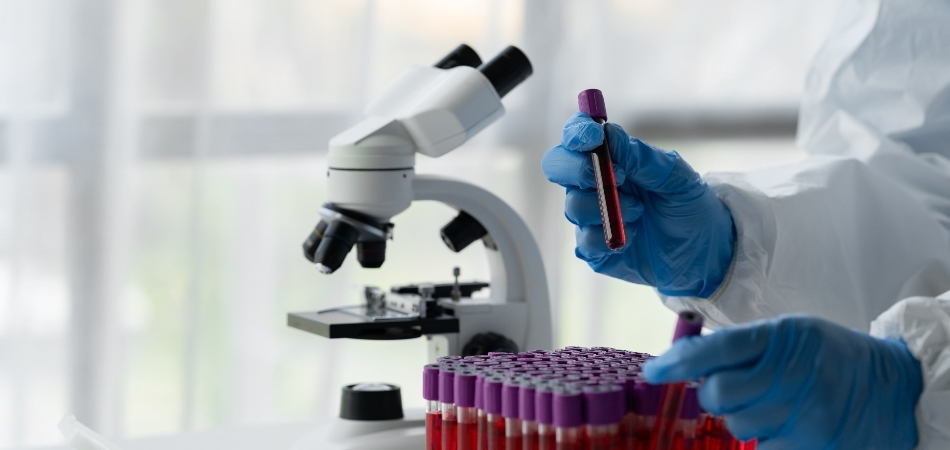 Laktat nedir? Laktat yüksekliği ne anlama gelir?