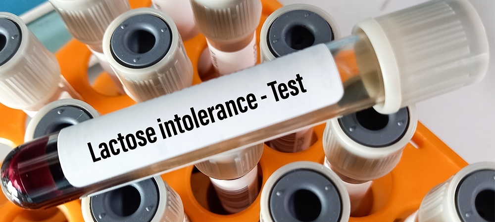 Laktoz intoleransı testi nedir? Laktoz hassasiyeti belirtileri nelerdir?